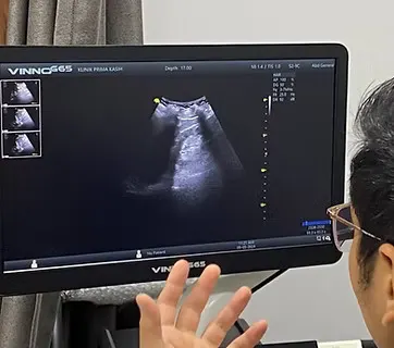 Ilustrasi perkhidmatan imbasan ultrasound