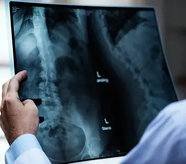 Status perkhidmatan X-ray di Yan yang ditangguhkan sementara